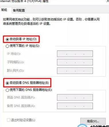 电脑IP自动获取问题解决攻略