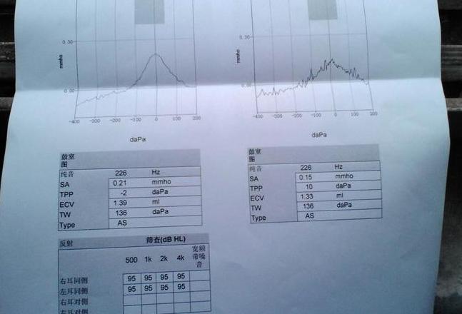 煤矿入职体检听力标准